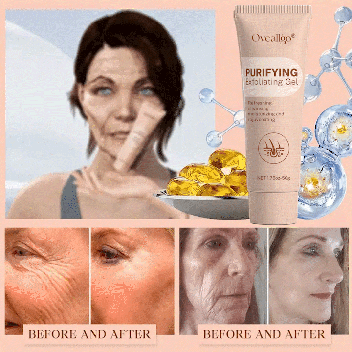 Oveallgo® Purifying Exfoliating Gel for Acanthosis Nigricans, Exfoliation, Dark Spots, Skin Tags, and Eczema_Ultra01
