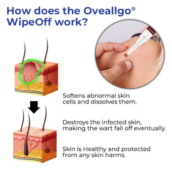 ✅Official Store: Oveallgo® WipeOff Tags & Moles Remover👨⚕️The American Academy of Dermatology (AADA) Approved