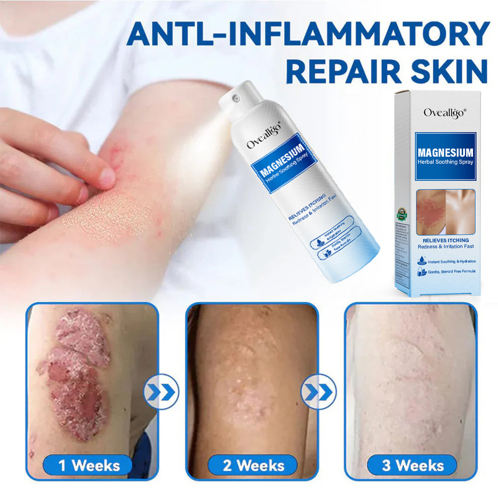 Oveallgo® Magnesium Herbal Psoriasis Spray
