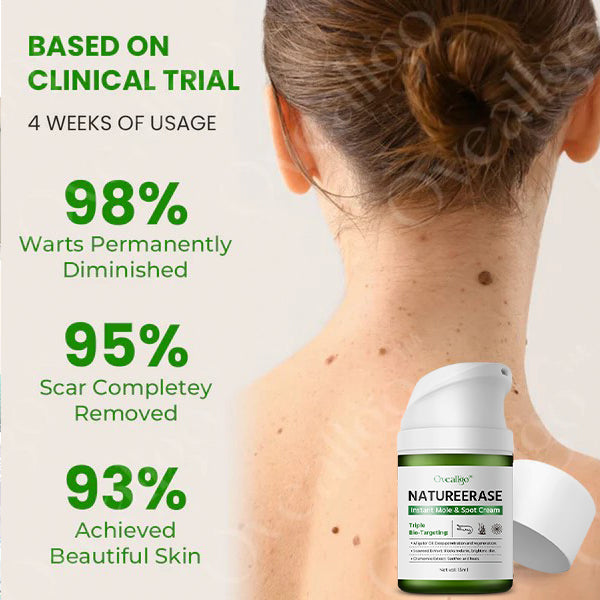 ✅ Official Store: Oveallgo® NatureErase Plus Instant Mole & Spot Cream