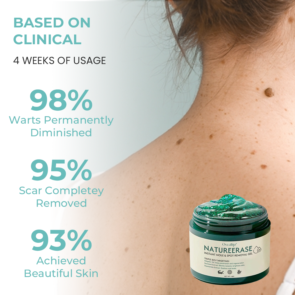 ✅ Official Store: Oveallgo® NatureErase Promax Instant Mole & Spot Removal Gel