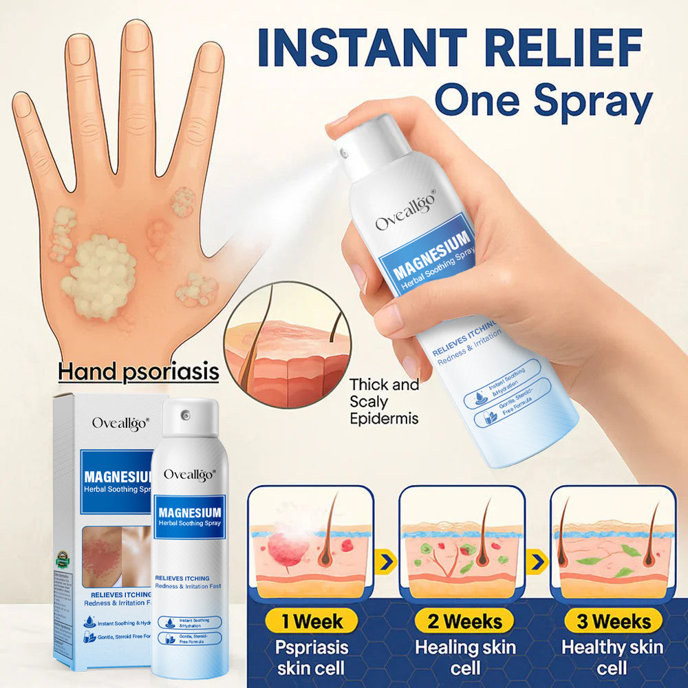 Oveallgo® Magnesium Herbal Psoriasis Spray