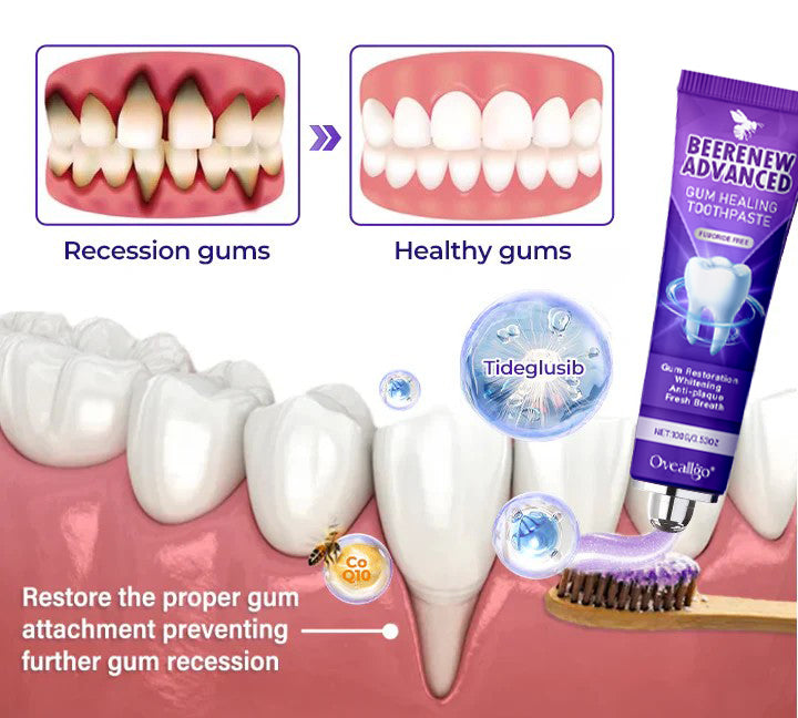 Oveallgo® BeeRenew Advanced Gum Healing Toothpaste