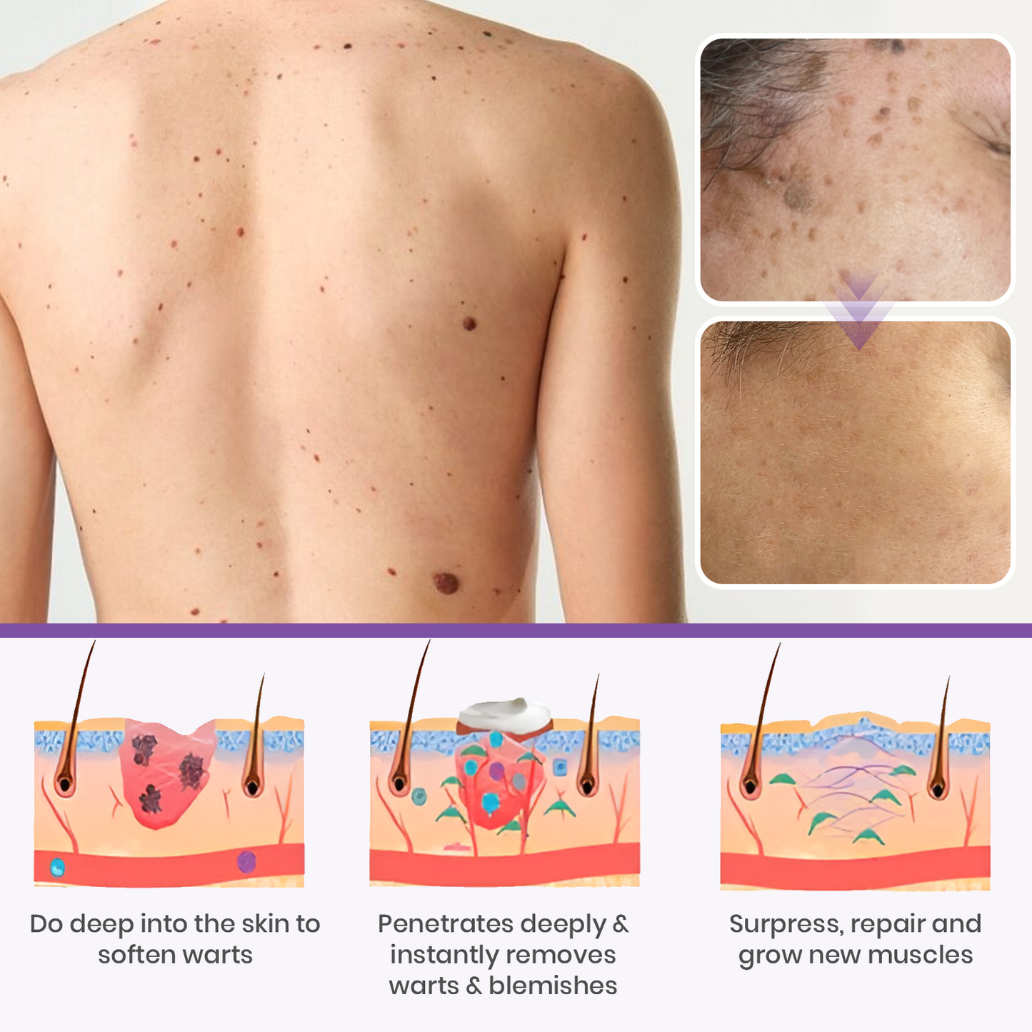 Oveallgo® Clarivine Dissolver Pro Mole & Dark Spot Removal Bio-Gel