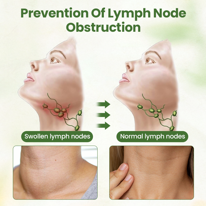 Oveallgo® Lymphatic Detox Herbal Cream