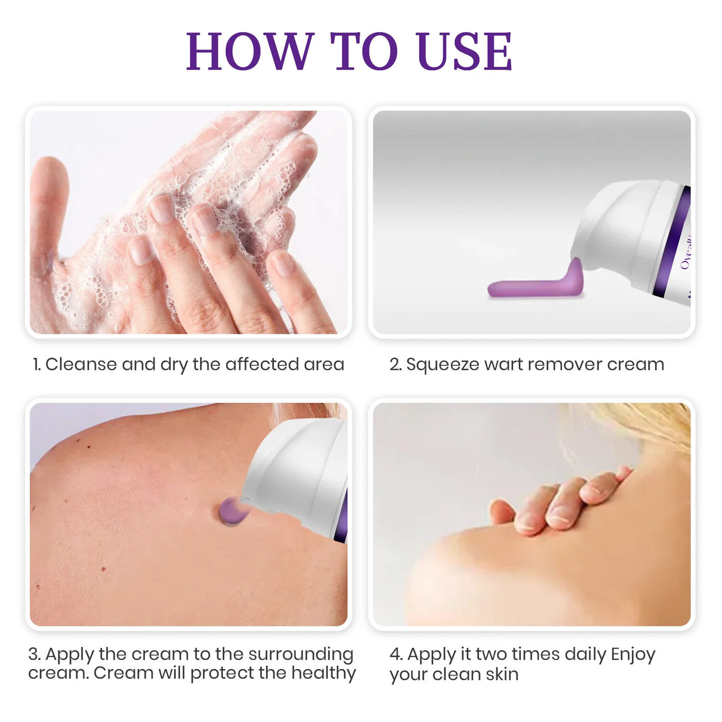 Oveallgo® NATURESTORE Pro Instant Mole & Spot Cream - Limited Discount