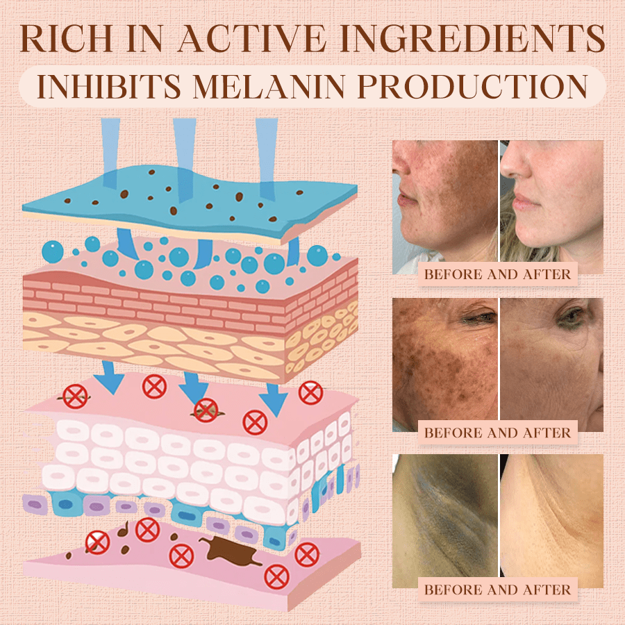 Oveallgo® Purifying Exfoliating Gel for Acanthosis Nigricans, Exfoliation, Dark Spots, Skin Tags, and Eczema_Ultra01