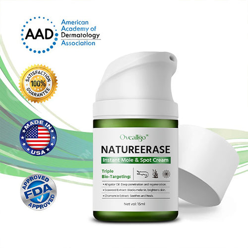 ✅ Official Store: Oveallgo® NatureErase Plus Instant Mole & Spot Cream