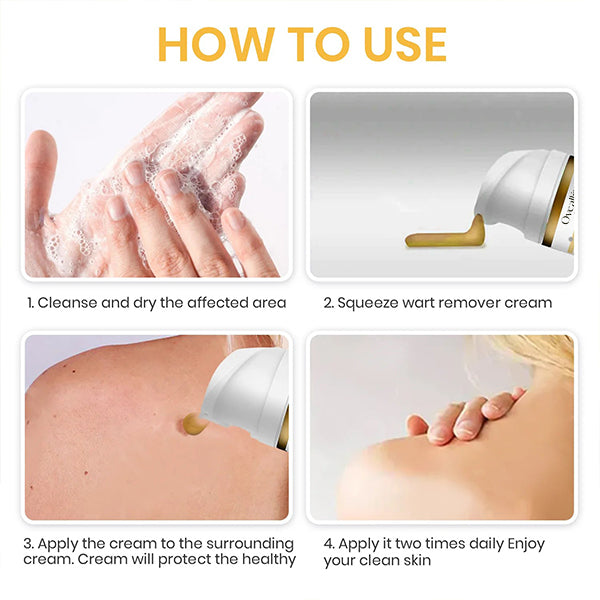 Oveallgo® NATURESTORE Instant Mole & Spot Cream