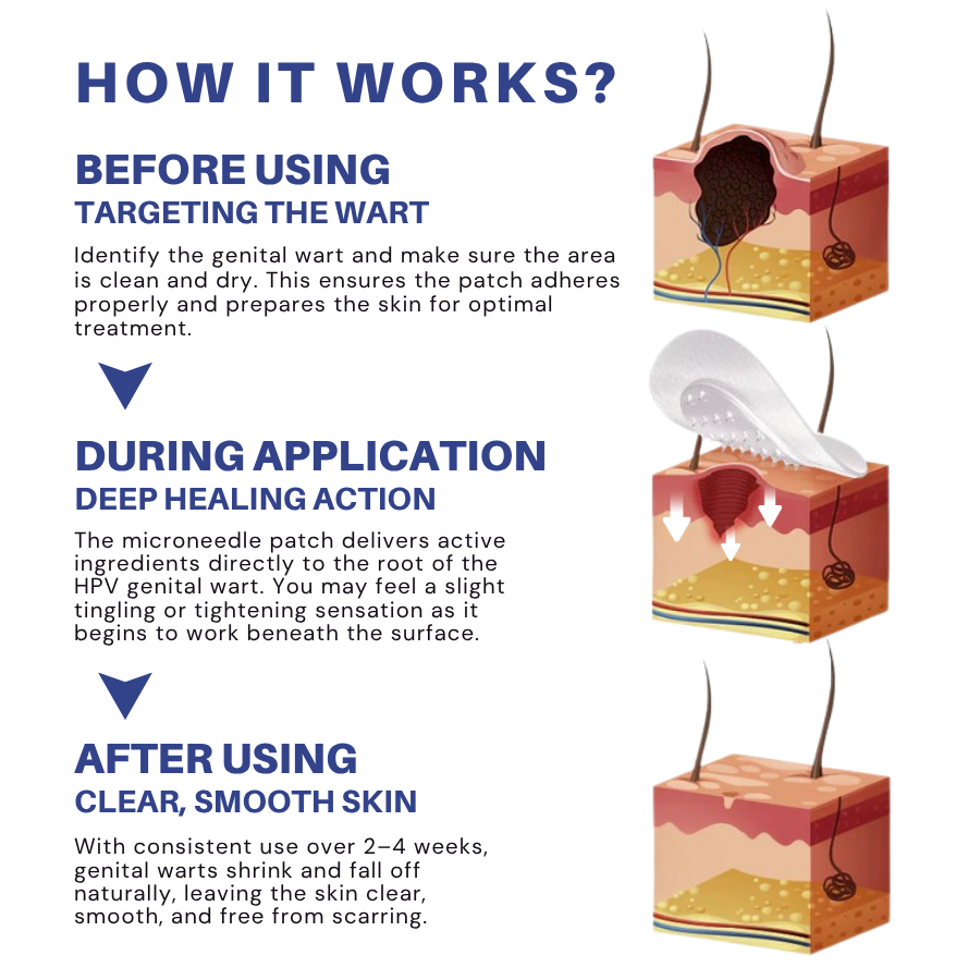 Fivfivgo® Microneedle HPV Genital Warts Removal Patch