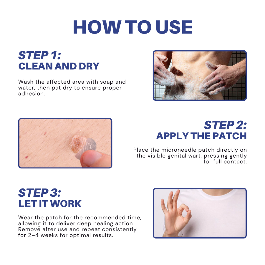 Fivfivgo® Microneedle HPV Genital Warts Removal Patch