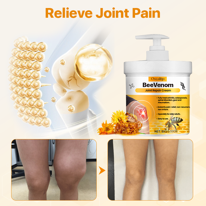 ✅Official Store: Oveallgo® BeeVenom Joint Repair Cream👨⚕️USA Osteopathic Medical Association(AAOS) Approved