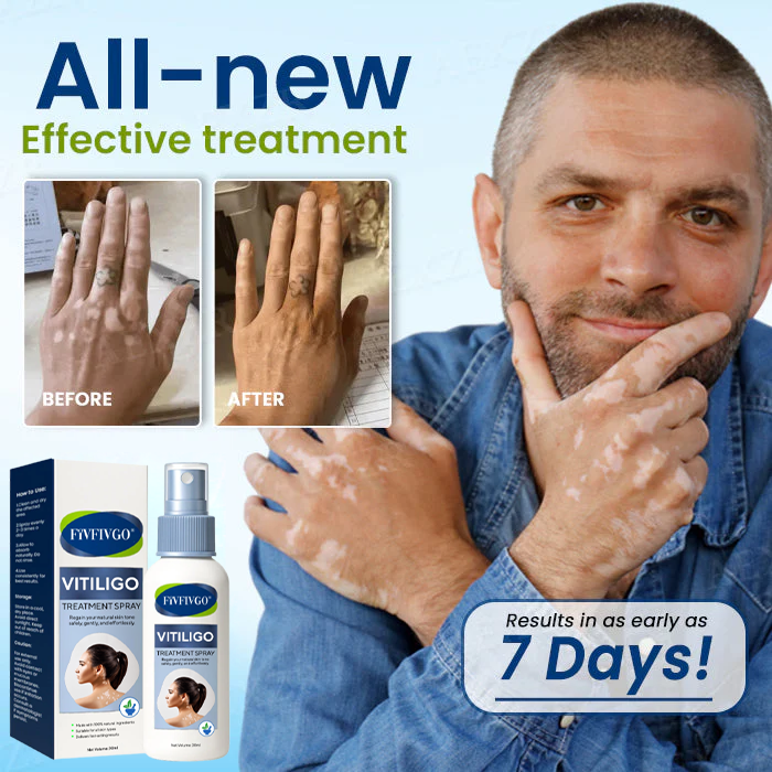 Fivfivgo® Vitiligo Treatment Spray