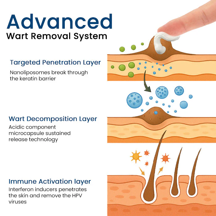 Fivfivgo® Herbal Genital Skin Treatment Cream ✅ Revolutionary Natural Solution for Genital Wart Treatment