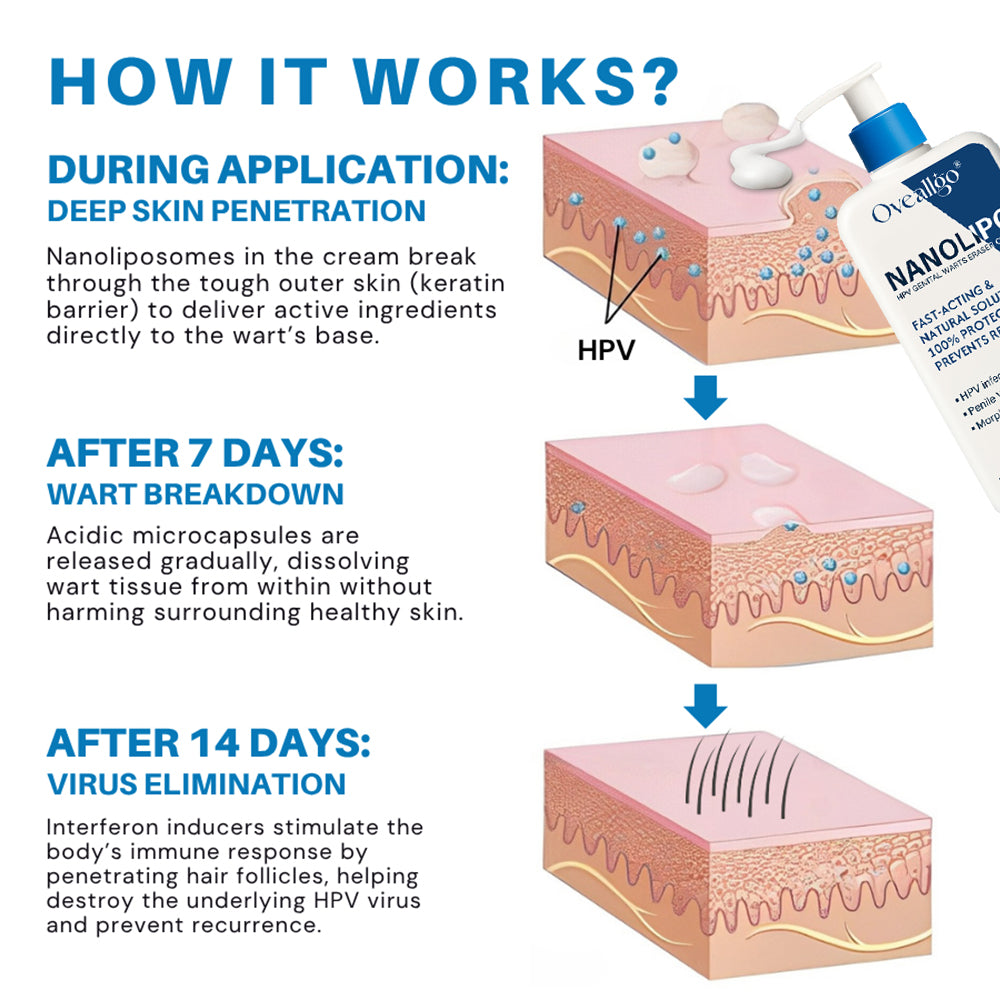 Oveallgo® NanoLipo HPV Genital Warts Eraser Cream Plus