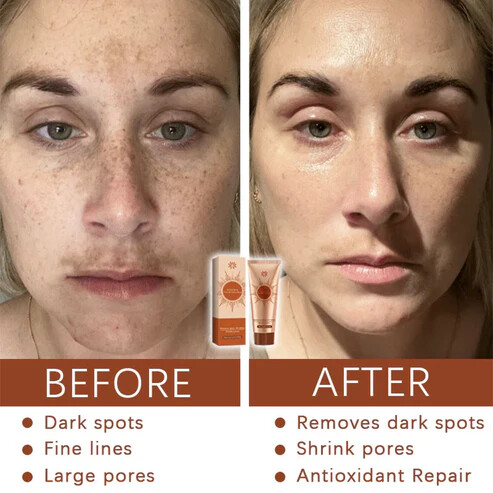 Fivfivgo® Herbal Spots Peel-Off Facial Mask Plus