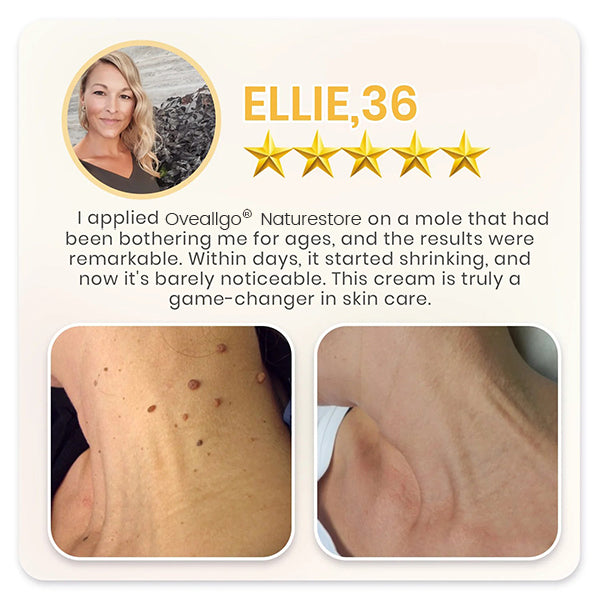 Oveallgo® NATURESTORE Instant Mole & Spot Cream