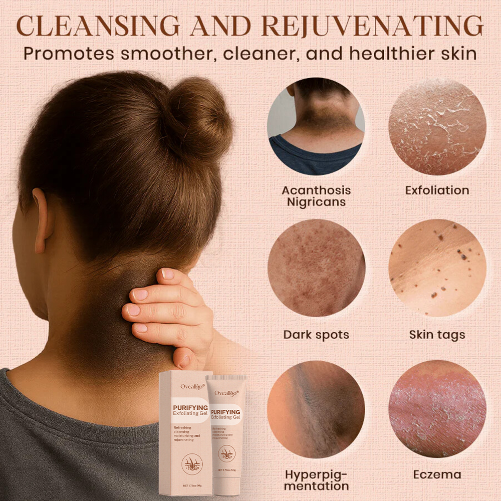 Oveallgo® Purifying Exfoliating Gel for Acanthosis Nigricans, Exfoliation, Dark Spots, Skin Tags, and Eczema_Ultra01