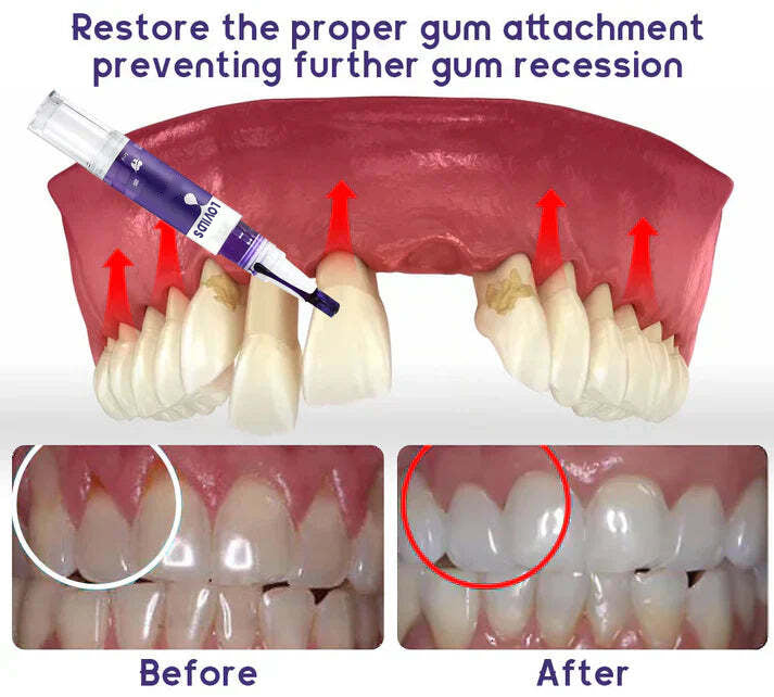 Oveallgo® Gum Care Gel – Restore & Strengthen Your Gums