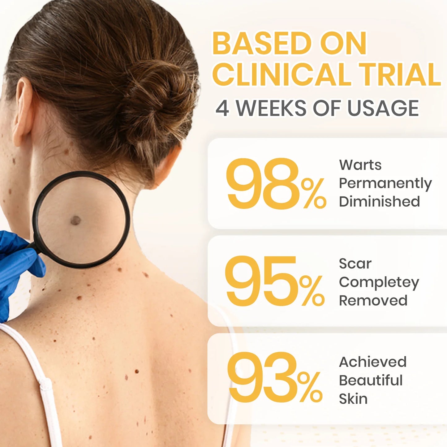 Oveallgo® NATURESTORE Instant Mole & Spot Cream