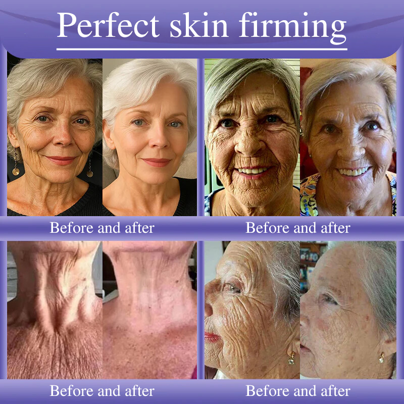 Oveallgo® Anti-Wrinkle Cream To Eliminate Wrinkles, Firm And Whiten The Skin - Last offer! 🔥90% discount