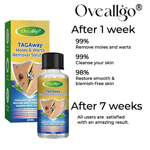 Oveallgo® TAGAway Moles & Warts Removal Solution
