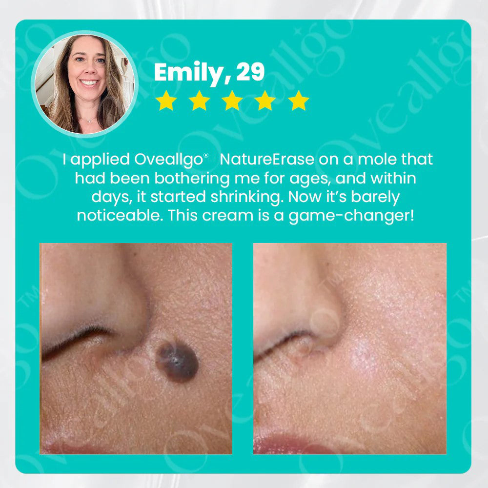 ✅ Official Store: Oveallgo® NatureErase Promax Instant Mole & Spot Removal Gel