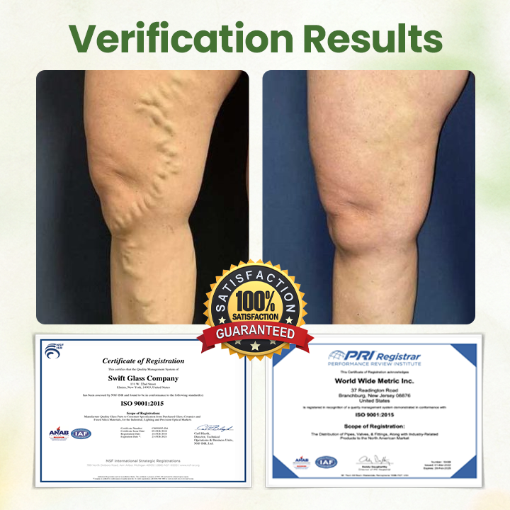 Oveallgo® Lymphatic Detox Herbal Cream