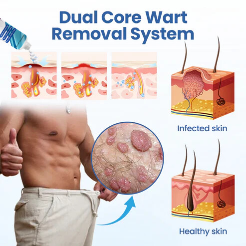Oveallgo® GentX WartRelief Cream