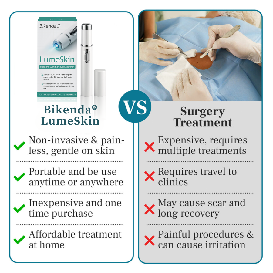 Bikenda® LumeSkin Mole and Wart Removal Laser Pen