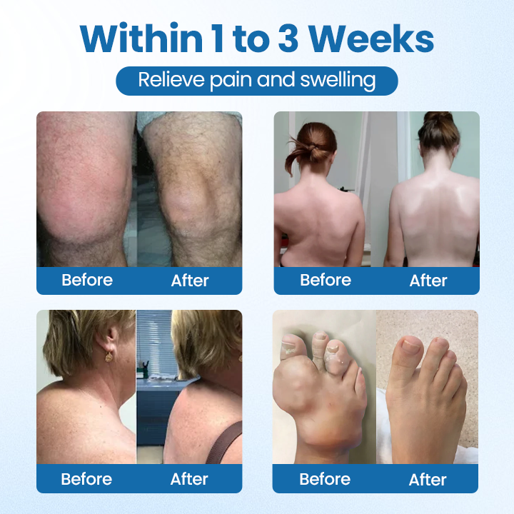 Oveallgo® BPC-157 Joint Repair Cream Pro