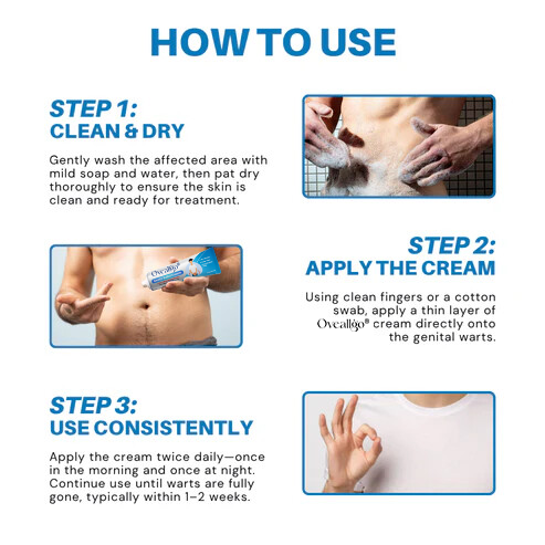 Oveallgo® HPV Genital Warts Relief Cream PRO