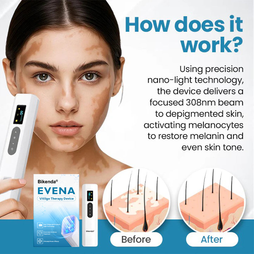 Bikenda® Evena Vitiligo Therapy Device PRO