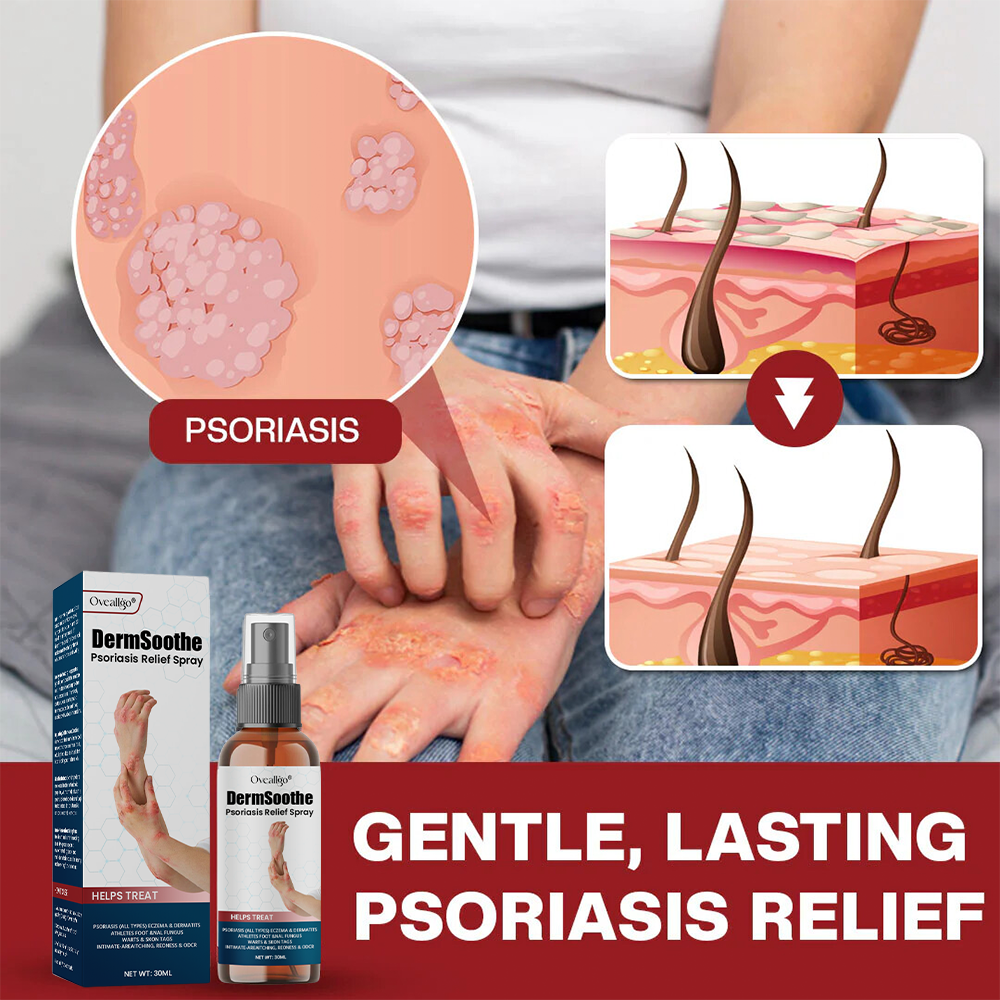 Oveallgo® DermSoothe Psoriasis Relief Spray