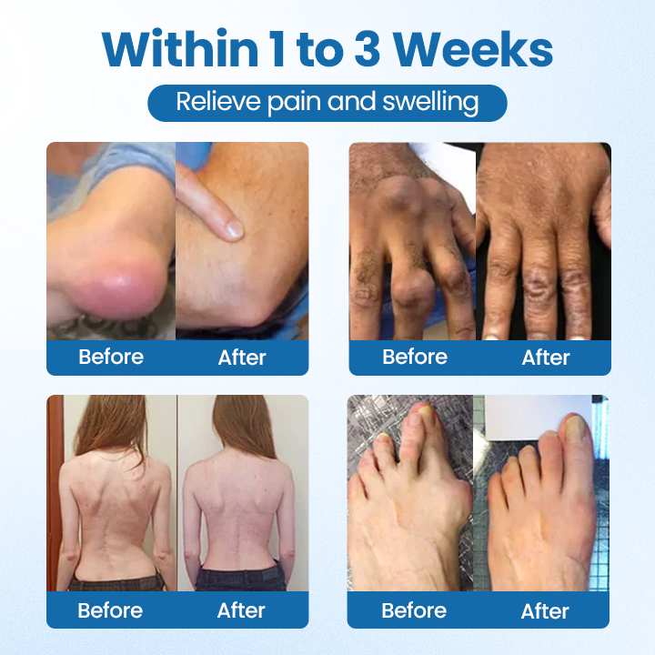 Oveallgo® BPC-157 Joint Repair Cream Pro