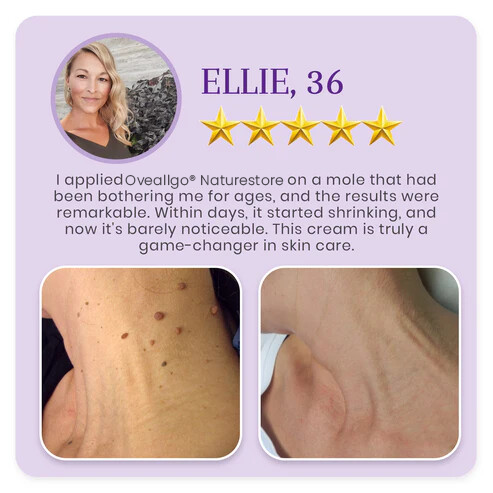 Oveallgo® NATURESTORE Pro Instant Mole & Spot Cream - Limited Discount