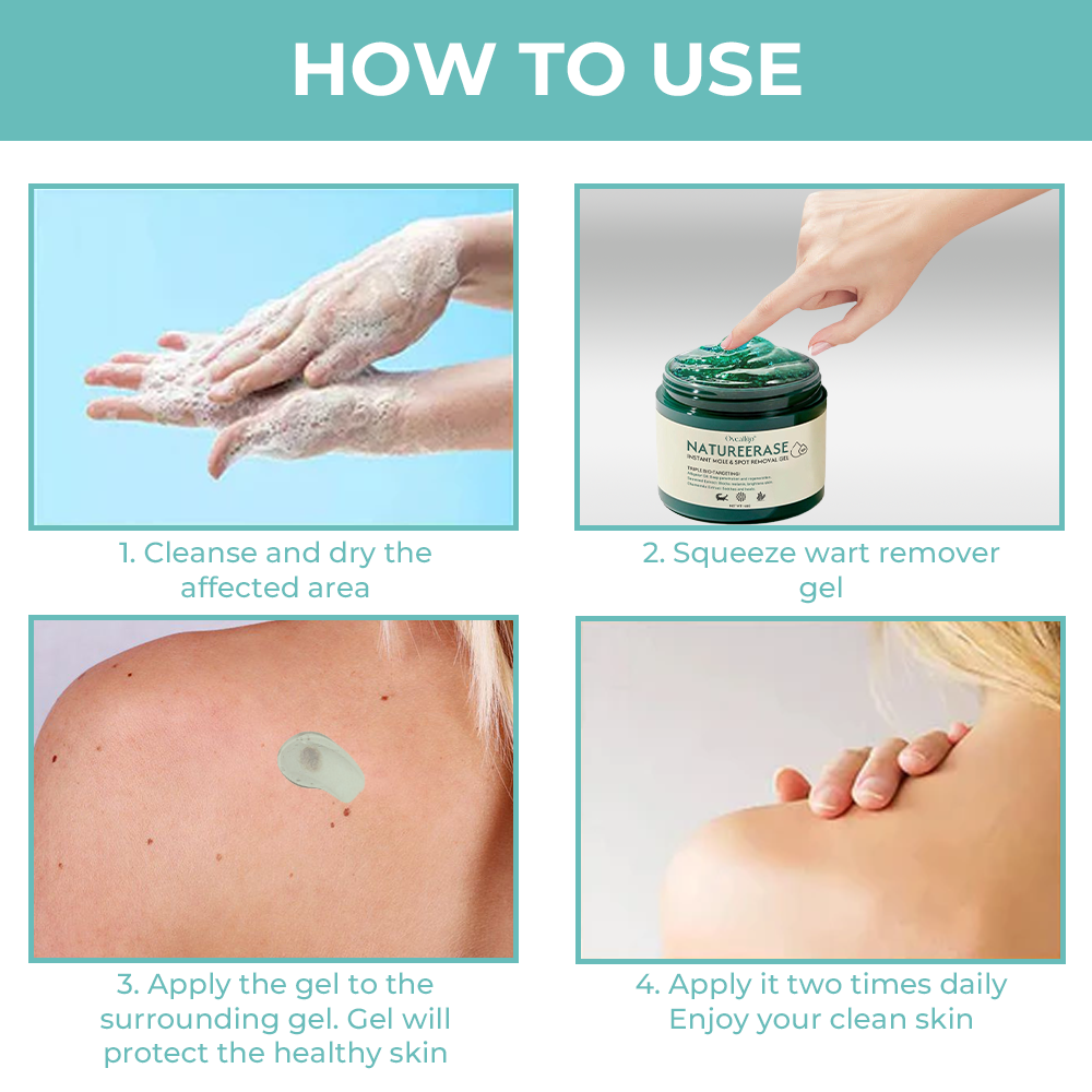 ✅ Official Store: Oveallgo® NatureErase Promax Instant Mole & Spot Removal Gel