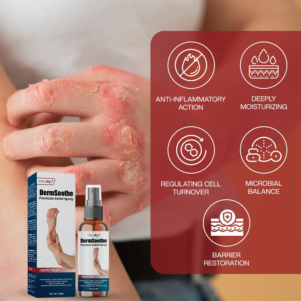 Oveallgo® DermSoothe Psoriasis Relief Spray
