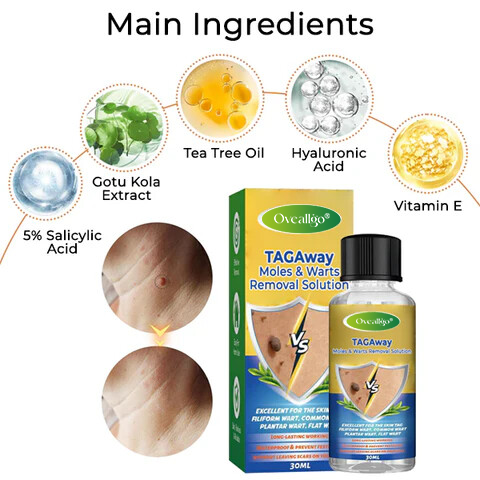 Oveallgo® TAGAway Moles & Warts Removal Solution