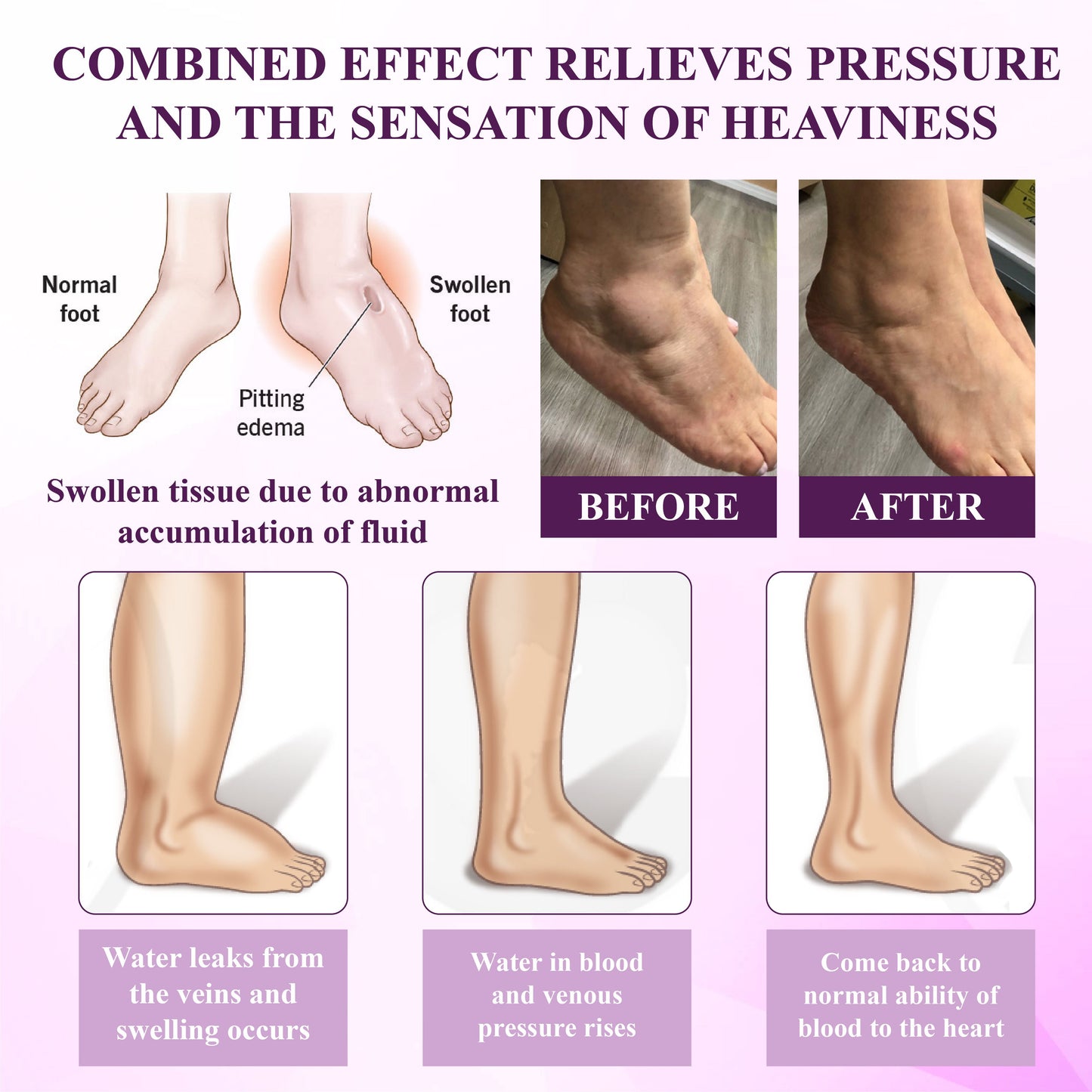 Oveallgo® NightDrain Leg Therapy Edema Cream