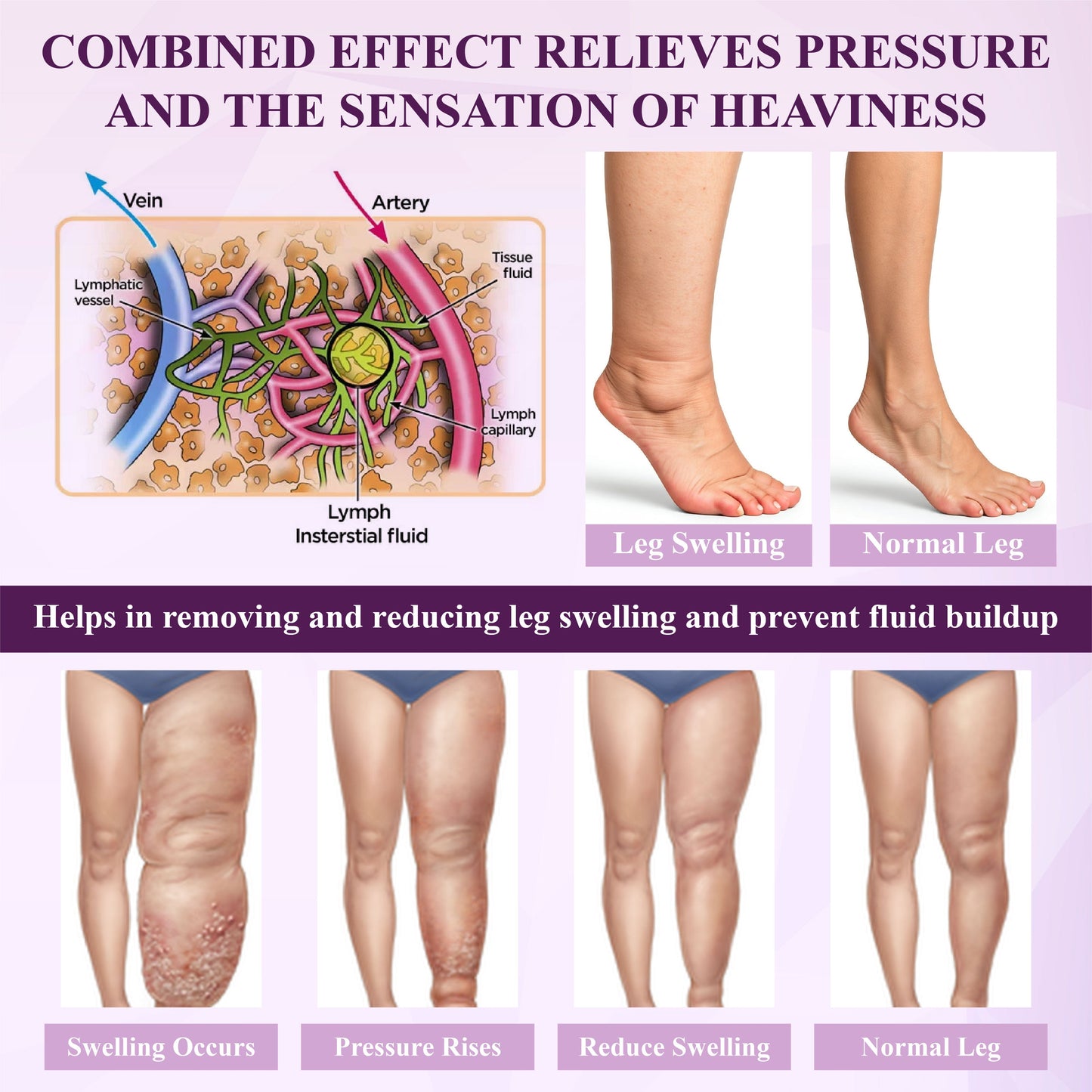 Oveallgo® NightDrain Leg Therapy Edema Cream