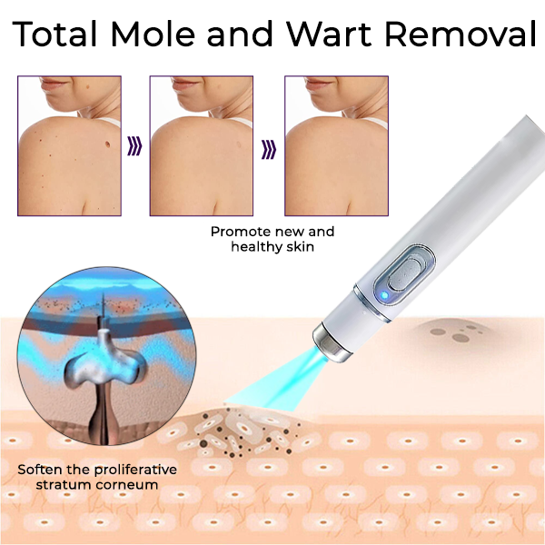 Bikenda® Mole and Wart Removal Laser Set PRO