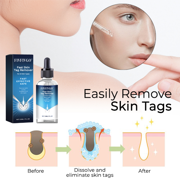 Fivfivgo® Fast Skin Tag Remover for All Skin Types