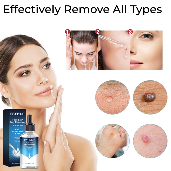 Fivfivgo® Fast Skin Tag Remover for All Skin Types