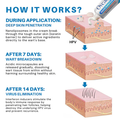 Oveallgo® HPV Genital Warts Relief Cream PRO