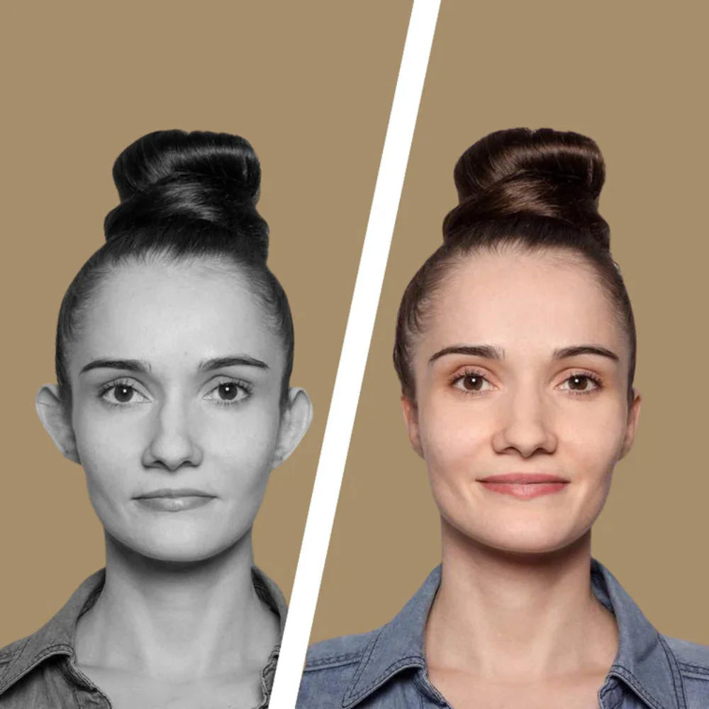 Oveallgo® Ear Correctors