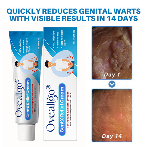Oveallgo® HPV Genital Warts Relief Cream PRO