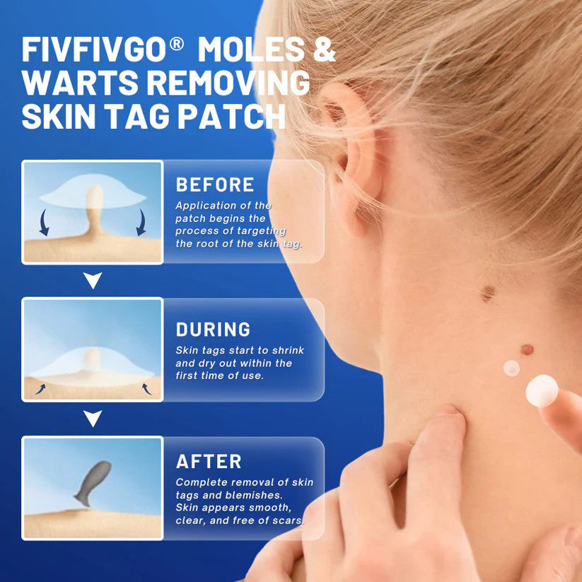 Fivfivgo® Moles & Warts Removing Skin Tag Patch