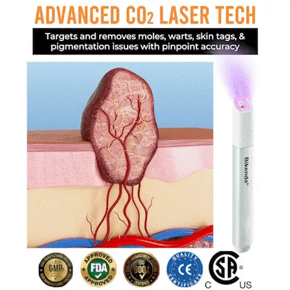 ✨Bikenda® All-in-One CO₂ Laser Eraser Pen | Removes Moles, Warts, Skin Flaws & Pigmentation