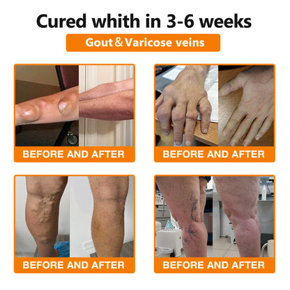 Fivfivgo™ Bee Venom and Turmeric Joint and Bone Pain Relief Spray (Specialized in Joint and Arthritis Pain & Recommended by AAOS)